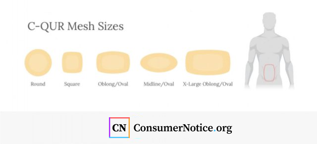 Infographic of C-QUR various mesh sizes.