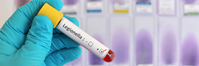 Legionella test tubes