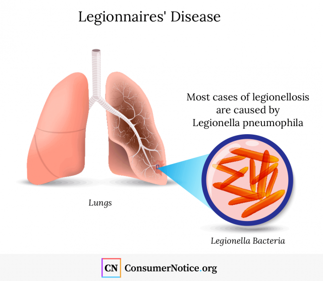 Infographic about Legionnaires' Disease