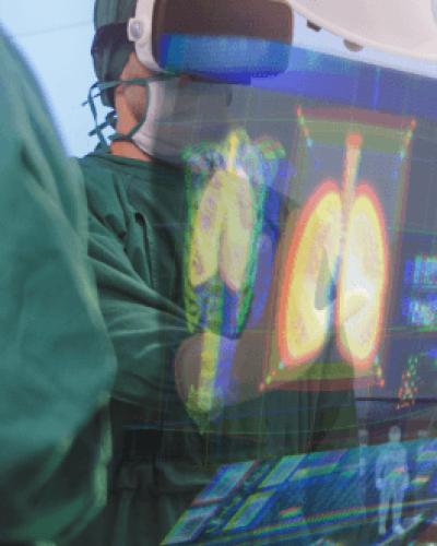 Surgeons working on patients lungs using Virtual Reality tools