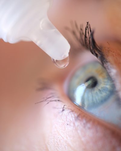 Eye drops going into woman's eye