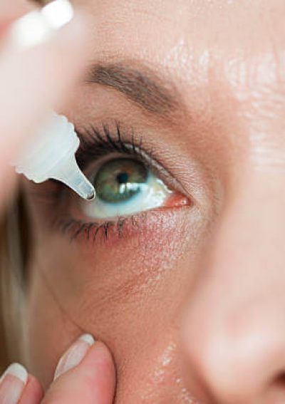 Woman placing eyedrops in her eye.