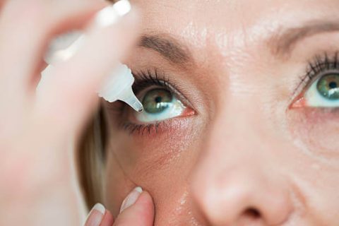 Woman placing eyedrops in her eye.