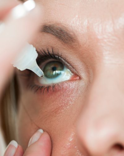 Eye drops going into woman's eye
