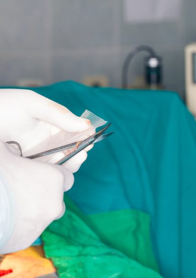 Surgeon cutting a piece of hernia mesh