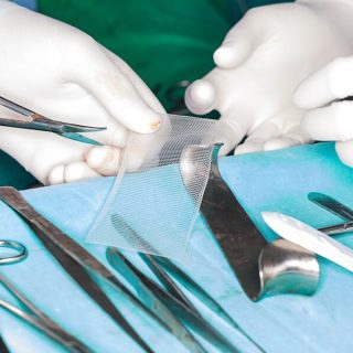 surgical mesh and tools