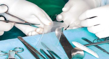 surgical mesh and tools