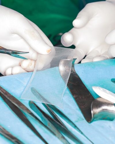surgical mesh and tools