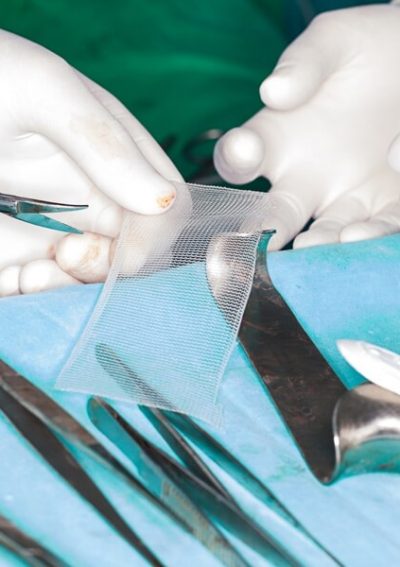 surgical mesh and tools