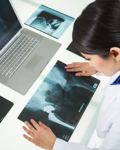 doctor looking at hip xrays